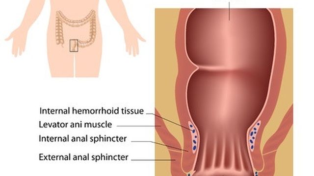 Jual Ambejoss Salep Salwa Obat Wasir De Nature Di Manokwari Selatan